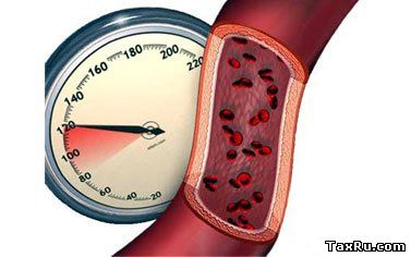 Как снизить давление без лекарств