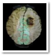 картинка «Большой зубной обман»