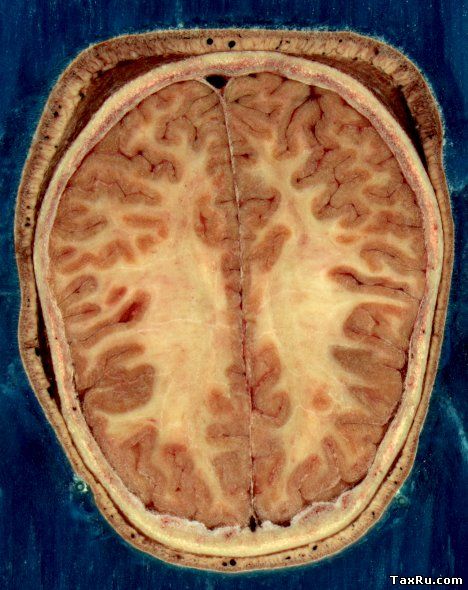Головной мозг в разрезе взрослой женщины