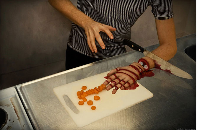 Необычные синдромы в медицине