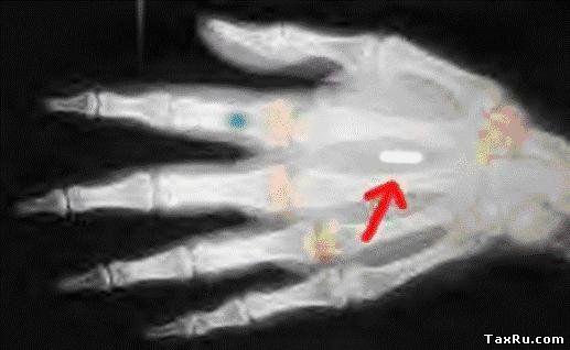 Разработчик человеческих чипов рассказывает о мировом заговоре