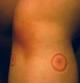 точки жизни на теле человека tochki jizni na tele cheloveka